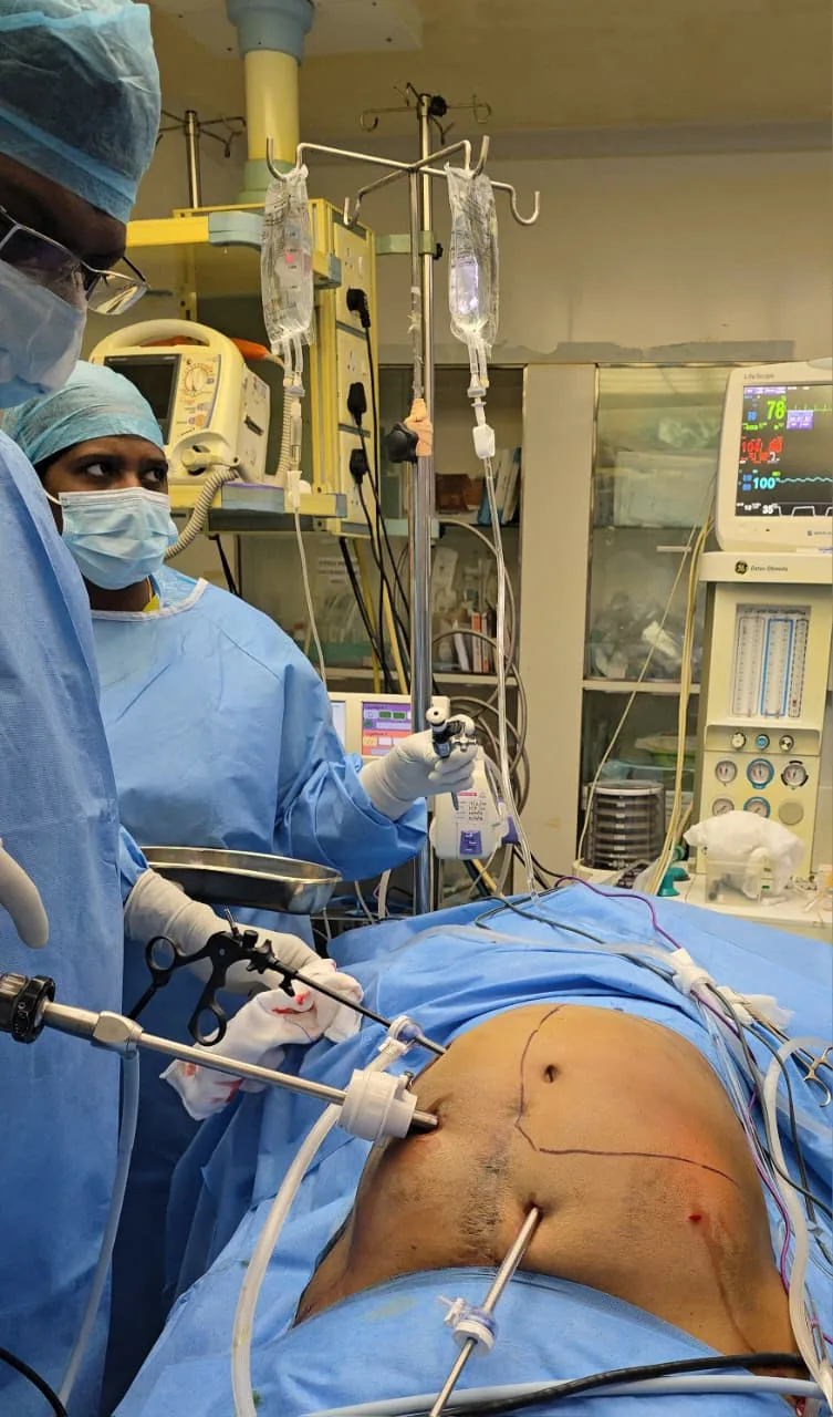 Laparoscopic surgery in progress